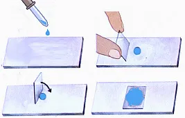 Метод раздавленной капли