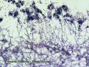 Набор микропрепаратов Bresser 100 шт., в кейсе, изображение 7